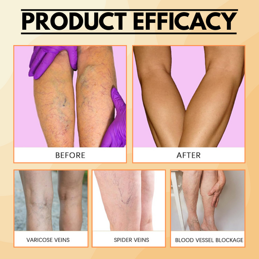 GoldenHeal™ - Turmeric Patches For Varicose Veins and Pain Relief