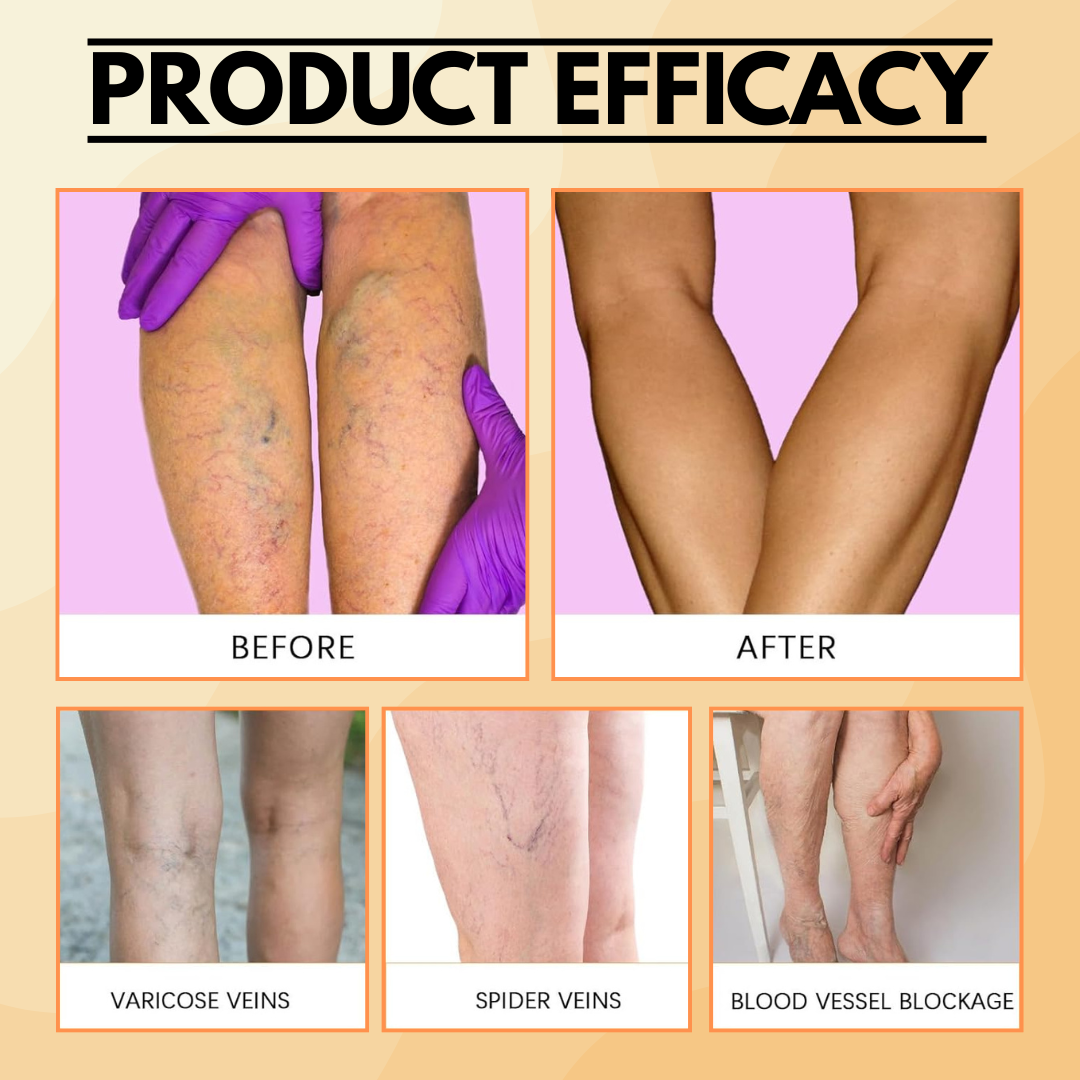 GoldenHeal™ - Turmeric Patches For Varicose Veins and Pain Relief